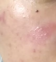 제 피부는 속은 건조히고 겉은 기름이 좔좔 흐르는 유슈분 밸런스 꾕인 상태였어요 컨디