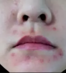 여지껏 살면서 아무 화장품이나 써도
