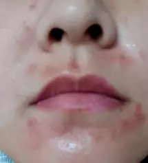 여지껏 살면서 아무 화장품이나 써도
