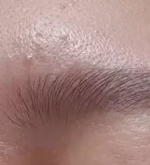 응급토닉 아침저녁 사용+스팟 저녁 사용으로
