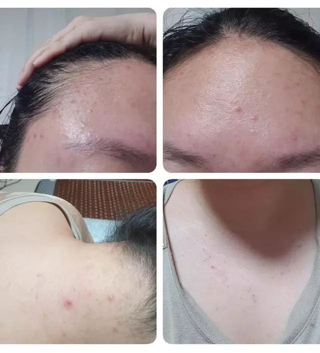 불가리안로즈 라인을 쓰면서 진짜 트러블없는피부 몇년째 유지중이에요.말그대로 정말 