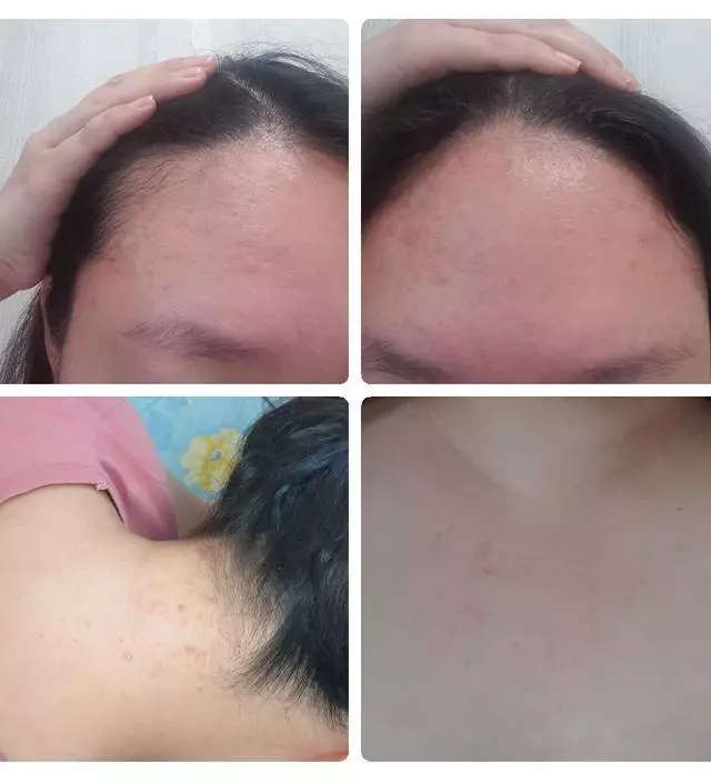 불가리안로즈 라인을 쓰면서 진짜 트러블없는피부 몇년째 유지중이에요.말그대로 정말 