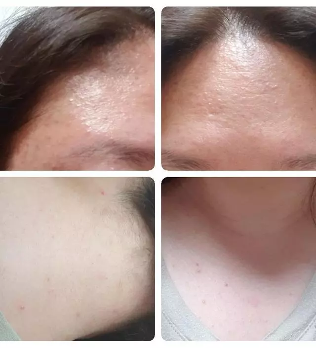 불가리안로즈 라인을 쓰면서 진짜 트러블없는피부 몇년째 유지중이에요.말그대로 정말 